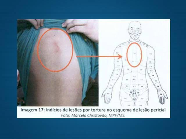 Interno disse ter sido agredido por agentes