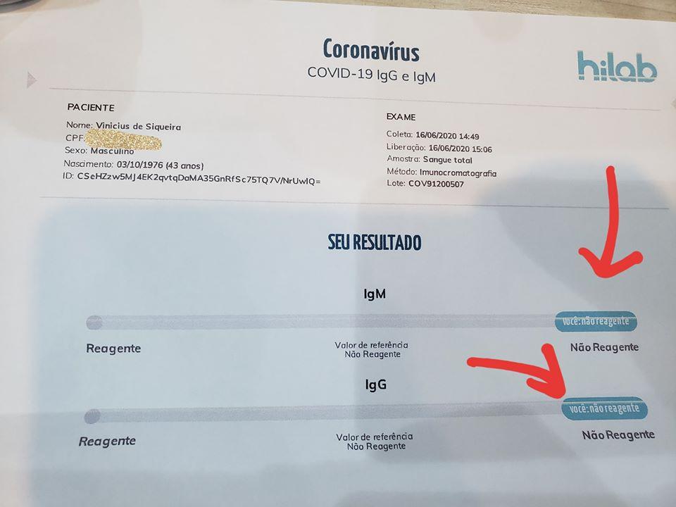 Após contato com infectado, vereador da Capital testa negativo para coronavírus