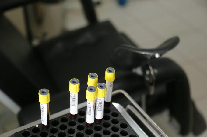 No Dia da Luta contra Aids, medo de testar positivo ainda é barreira para tratamento em MS