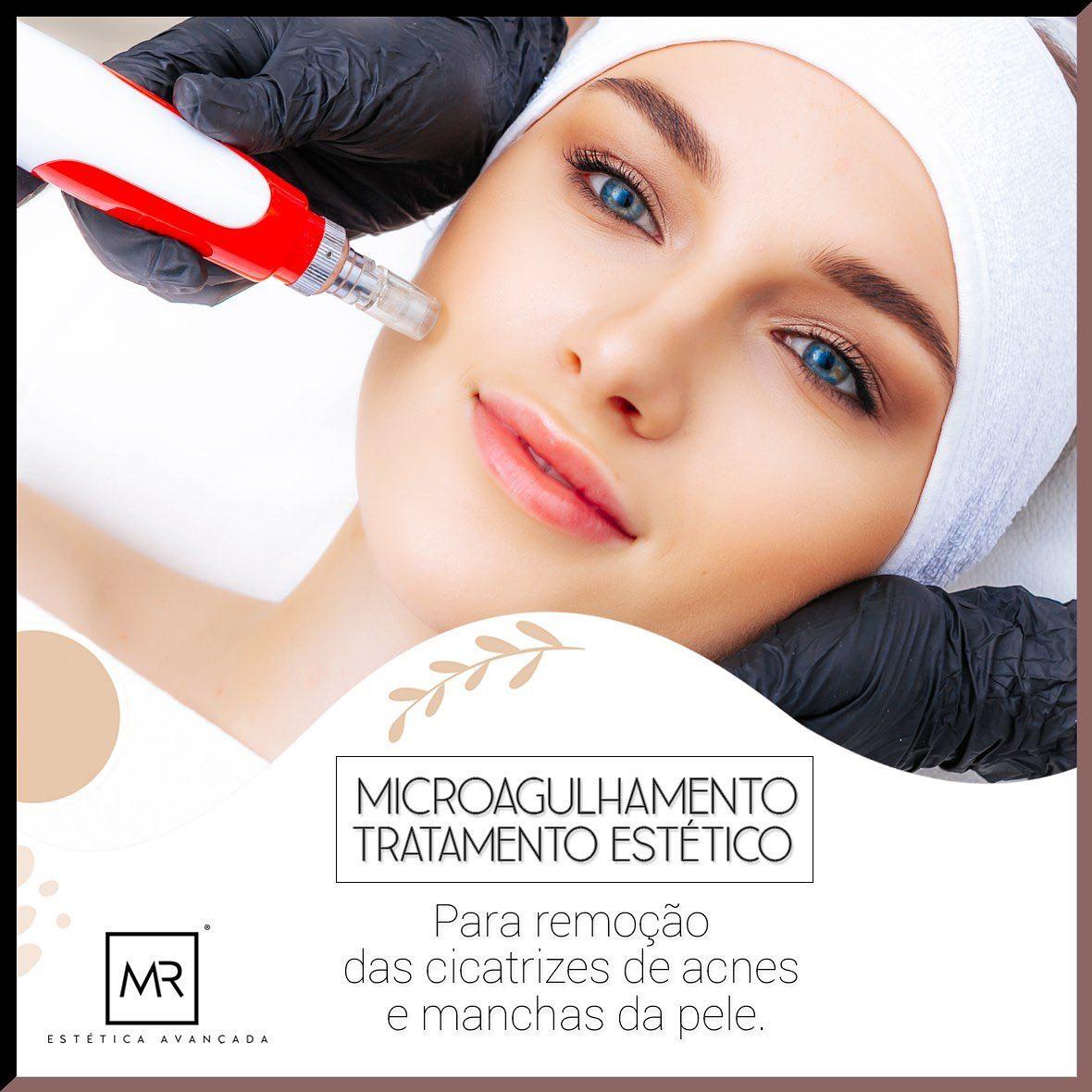 Empodere-se! Realce a beleza e juventude de seu rosto e corpo na MR Estética Avançada 