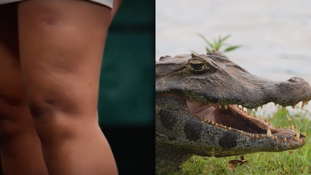 Bella mostrou as marcas da mordida de jacaré em sua perna - (Fotos: Reprodução GNT e UFMS
