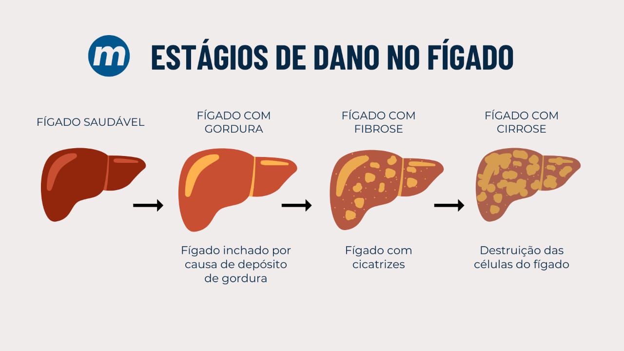 Gordura no fígado