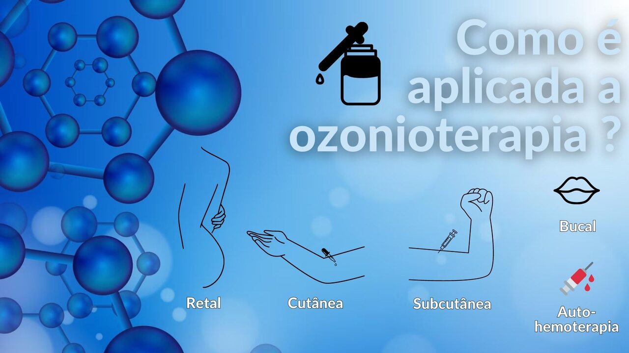Ozonioterapia